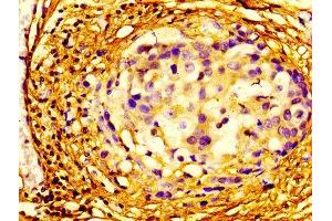 anti-Eukaryotic Translation Initiation Factor 4A2 (EIF4A2) (AA 1-407) antibody