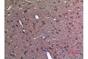 Immunohistochemistry (IHC) analysis of paraffin-embedded Rat Brain, antibody was diluted at 1:100. (UBE2A/B (C-Term) anticorps)