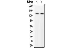Western blot analysis of p116 Rip expression in U251MG (A), NIH3T3 (B) whole cell lysates. (MPRIP anticorps  (Center))
