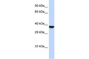 Host:  Rabbit  Target Name:  TMPPE  Sample Type:  721_B Whole cell lysates  Antibody Dilution:  1. (TMPPE anticorps  (N-Term))