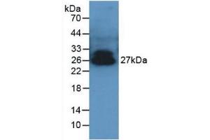 Detection of ADPN in Porcine Serum using Polyclonal Antibody to Adiponectin (ADPN) (ADIPOQ anticorps  (AA 17-243))