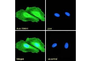 (ABIN184669) Immunofluorescence analysis of paraformaldehyde fixed HeLa cells, permeabilized with 0.