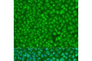 Immunofluorescence analysis of U2OS cells using CHEK1 Polyclonal Antibody at dilution of 1:100. (CHEK1 anticorps)