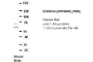 Image no. 2 for anti-Downstream Neighbor of SON (DONSON) (Middle Region) antibody (ABIN2782388)