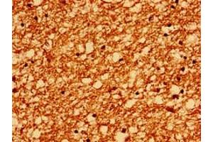 Immunohistochemistry of paraffin-embedded human brain tissue using ABIN7167523 at dilution of 1:100 (PTPRZ1 anticorps  (AA 36-300))