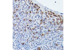 Immunohistochemistry of paraffin-embedded human tonsil using GPR109A/HM74A/HC Rabbit pAb (ABIN7267804) at dilution of 1:25 (40x lens). (HCAR2 anticorps  (AA 250-350))