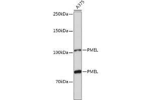Western blot analysis of extracts of  cells, using PMEL antibody (ABIN7269510) at 1:1000 dilution. (Melanoma gp100 anticorps  (AA 25-300))