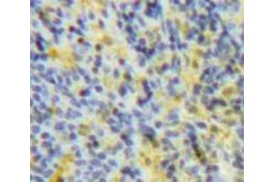IHC-P analysis of Spleen tissue, with DAB staining. (SOCS3 anticorps  (AA 1-225))