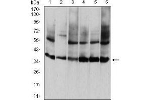 Western blot analysis using ANXA5 mouse mAb against HepG2 (1), PNAC-1 (2), NIH/3T3 (3), Hela (4), MCF-7 (5), and A431 (6) cell lysate. (Annexin V anticorps  (AA 160-320))