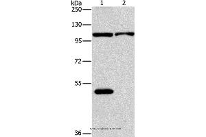 Western blot analysis of K562 and hela cell, using NLRP3 Polyclonal Antibody at dilution of 1:88 (NLRP3 anticorps)