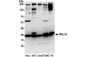 anti-Ribosomal Protein L15 (RPL15) (AA 50-100) antibody