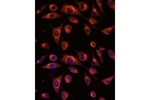 Immunofluorescence analysis of L929 cells using SC antibody (ABIN7270188) at dilution of 1:100. (SCAMP2 anticorps  (AA 1-152))