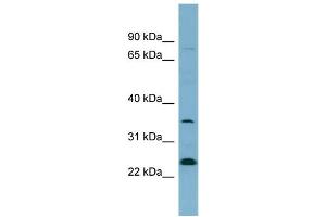 WB Suggested Anti-NOSIP  Antibody Titration: 0. (NOSIP anticorps  (N-Term))