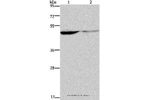 Western blot analysis of Human paraneoplastic and normal kidney tissue, using KCNK9 Polyclonal Antibody at dilution of 1:650 (KCNK9 anticorps)