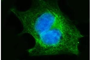 IF analysis of FGFR3 using anti-FGFR3 antibody (ABIN7603047).