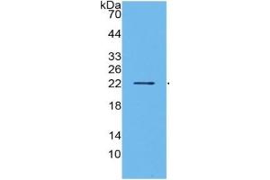 WB of Protein Standard: different control antibodies  against Highly purified E. (IL1A Kit ELISA)