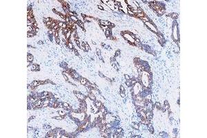 IHC analysis of Cytokeratin 8/KRT8 using anti-Cytokeratin 8/KRT8 antibody (ABIN5518853).