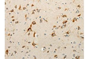 The image on the left is immunohistochemistry of paraffin-embedded Human brain tissue using ABIN7130917(RPAP3 Antibody) at dilution 1/15, on the right is treated with fusion protein.