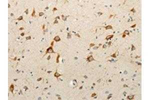 The image on the left is immunohistochemistry of paraffin-embedded Human brain tissue using ABIN7130917(RPAP3 Antibody) at dilution 1/15, on the right is treated with fusion protein. (RPAP3 anticorps)