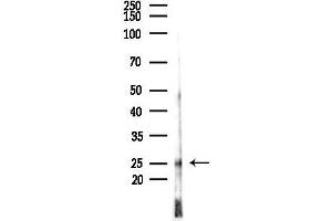 anti-High Mobility Group Box 2 (HMGB2) (Internal Region) antibody