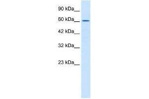 TRIM17 antibody used at 2. (TRIM17 / RNF16 anticorps  (Middle Region))