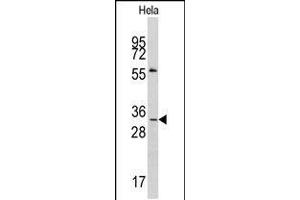Western blot analysis of anti-MAGEA1 Antibody in Hela cell line lysates (35ug/lane). (MAGEA1 anticorps  (AA 143-173))
