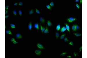 Immunofluorescence staining of Hela cells with  at 1:333, counter-stained with DAPI. (TNRC6A anticorps  (AA 1-161))