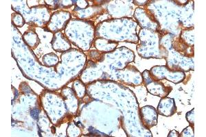 Formalin-fixed, paraffin-embedded human Placenta stained with CD71 Mouse Monoclonal Antibody (TFRC/1817). (Transferrin Receptor anticorps  (AA 94-212))