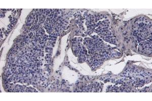 (ABIN7505817) Negative Control showing staining of paraffin embedded Human Testis, with no primary antibody.