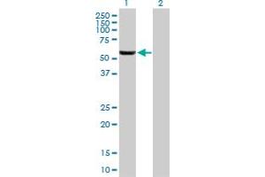 Western Blot analysis of GHDC expression in transfected 293T cell line by GHDC MaxPab polyclonal antibody. (GHDC anticorps  (AA 1-530))