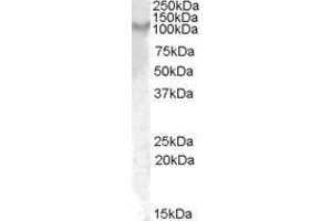 ABIN570920 (1µg/ml) staining of Rat Kidney lysate (35µg protein in RIPA buffer). (IL17RA anticorps  (Internal Region))