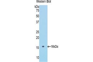 Western blot analysis of the recombinant protein. (COL6A1 anticorps  (AA 82-212))