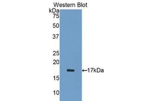 Western blot analysis of the recombinant protein. (ADAMTS1 anticorps  (AA 476-614))