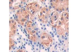 Used in DAB staining on fromalin fixed paraffin- embedded Kidney tissue