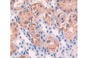 Used in DAB staining on fromalin fixed paraffin- embedded Kidney tissue (DGKG anticorps  (AA 346-576))