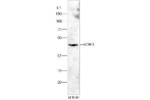 Lane 1:Rat brain lysates probed with Rabbit Anti-KCNK3 Polyclonal Antibody, Unconjugated  at 1:3000 for 90 min at 37˚C. (KCNK3 anticorps  (AA 181-280))