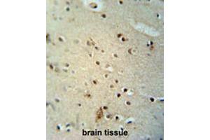 CIC antibody (N-term) immunohistochemistry analysis in formalin fixed and paraffin embedded human brain tissue followed by peroxidase conjugation of the secondary antibody and DAB staining. (CIC anticorps  (N-Term))