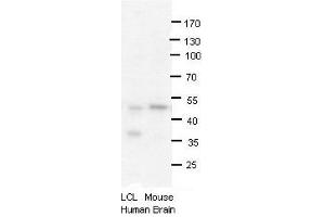 PRMT2 antibody - N-terminal region  validated by WB using human LCL and mouse brains at 1:1000.