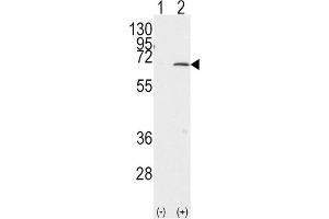 Western Blotting (WB) image for anti-Protein Inhibitor of Activated STAT, 1 (PIAS1) antibody (ABIN2996746) (PIAS1 anticorps)