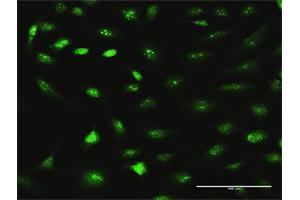 Immunofluorescence of purified MaxPab antibody to RRS1 on HeLa cell.