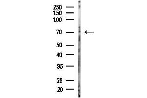 Western blot analysis of lysates from HUVEC cells(starvation,24h treatment), using Phospho-TIF1 alpha (Ser649) Antibody at 1/1000 dilution.