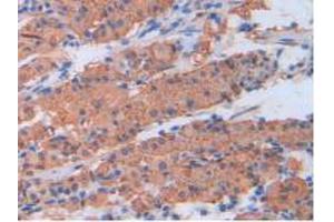 IHC-P analysis of Human Stomach Tissue, with DAB staining. (CRP anticorps  (AA 17-224))