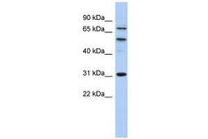 Image no. 1 for anti-Structure Specific Recognition Protein 1 (SSRP1) (AA 503-552) antibody (ABIN6742197) (SSRP1 anticorps  (AA 503-552))