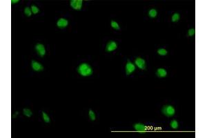 Image no. 4 for anti-V-Akt Murine Thymoma Viral Oncogene Homolog 1 (AKT1) (AA 1-481) antibody (ABIN598531) (AKT1 anticorps  (AA 1-481))