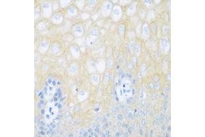 Immunohistochemistry of paraffin-embedded human esophagus using CDH1 antibody (ABIN5997408) at dilution of 1/100 (40x lens). (E-cadherin anticorps)