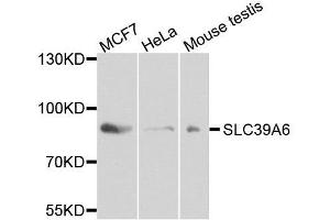 Western blot analysis of extracts of various cell lines, using SLC39A6 antibody. (SLC39A6 anticorps  (AA 170-320))