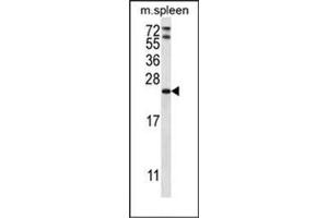 Western blot analysis of RAP1A Antibody (C-term) in mouse spleen tissue lysates (35ug/lane). (RAP1A anticorps  (C-Term))