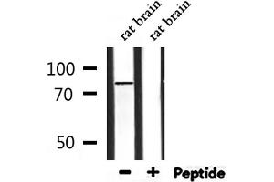 Western blot analysis of extracts from rat brain, using HADHA Antibody.