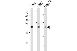 All lanes : Anti-SRY Antibody (N-Term) at 1:2000 dilution Lane 1: Hela whole cell lysates Lane 2: K562 whole cell lysates Lane 3: HepG2 whole cell lysates Lysates/proteins at 20 μg per lane. (SRY anticorps  (AA 52-82))