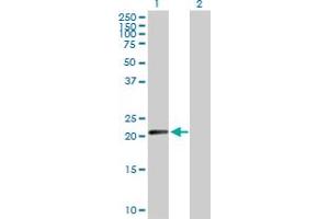Western Blot analysis of N6AMT1 expression in transfected 293T cell line by N6AMT1 MaxPab polyclonal antibody. (N6AMT1 anticorps  (AA 1-186))